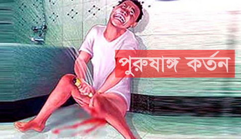 ধর্ষণ চেষ্টাকারীর পুরুষাঙ্গ কেটে দিলেন নারী