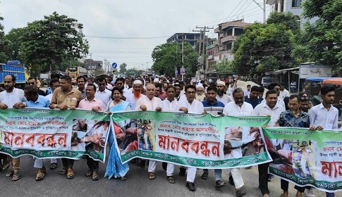 বড়াইগ্রামে শিক্ষককে কুপিয়ে জখম, প্রতিবাদে মানববন্ধন বিক্ষোভ 